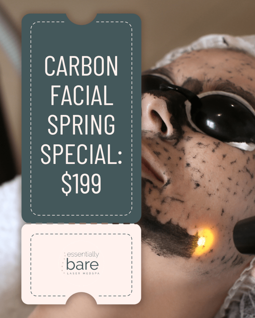 Promotional banner for a carbon facial spring special: $199, with Essentially Bare Laser MedSpa logo.